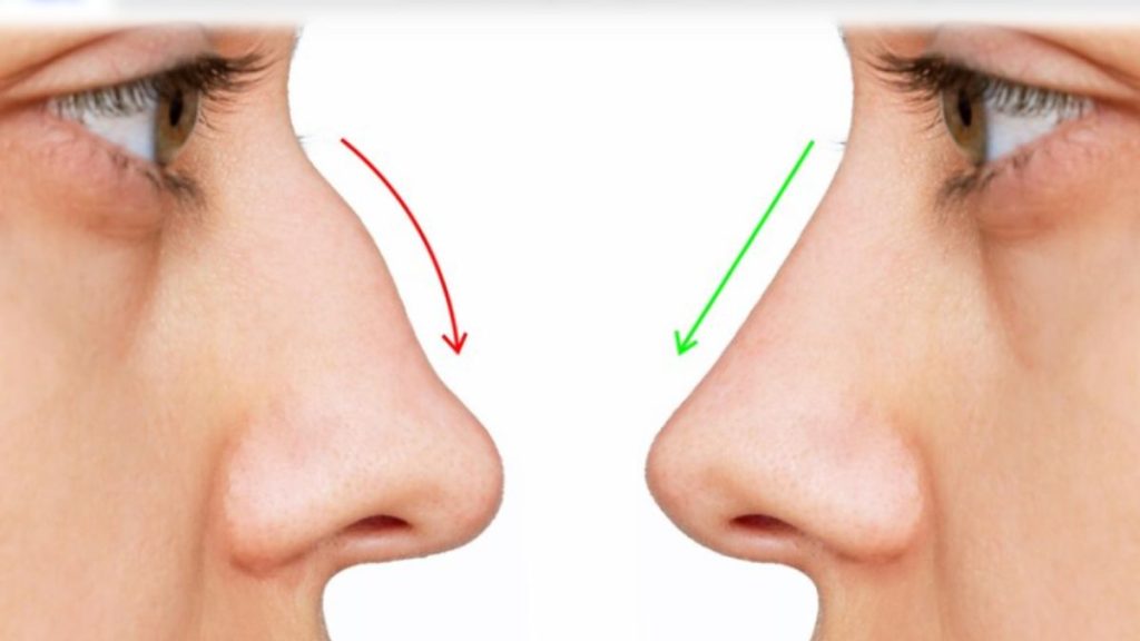 aquiline nose