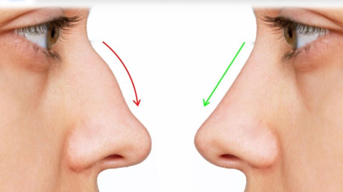 Understanding the Aquiline Nose Features and Significance Tumgazeteler
